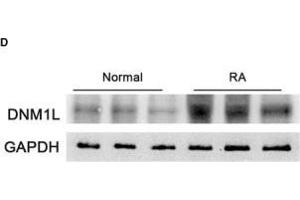 Enhanced mitochondrial fission in STs of RA patients correlates with disease severity.
