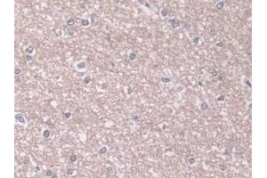 Detection of PLD in Human Cerebrum Tissue using Polyclonal Antibody to Phospholipase D (PLD)