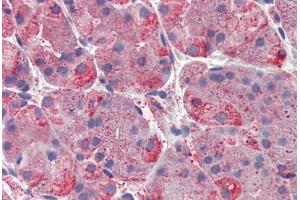 Human, Stomach: Formalin-Fixed Paraffin-Embedded (FFPE) (ERP44 anticorps  (C-Term))