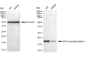 Western blotting analysis using ADP ribosylation factor 5 antibody (ABIN7797531). (Recombinant ARF5 anticorps)