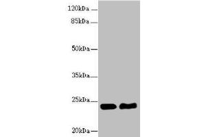 Western blot All lanes: RAB5B antibody at 5. (RAB5B anticorps  (AA 1-215))