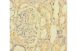 Immunohistochemistry of paraffin-embedded human kidney tissue using ABIN7154460 at dilution of 1:100 (PLA2G2D anticorps  (AA 22-145))