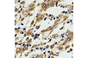Immunohistochemical analysis of EIF3A staining in human stomach formalin fixed paraffin embedded tissue section. (EIF3A anticorps)