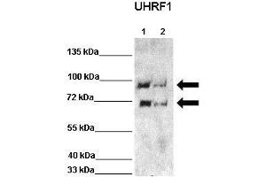 WB Suggested Anti-UHRF1 Antibody  Positive Control: Lane 1: 60ug HCT116 lysate Lane 2: 60ug HCT116 lysate + siRNA  Primary Antibody Dilution :  1:1000 Secondary Antibody : Anti rabbit-HRP  Secondry Antibody Dilution :  1:5,000 Submitted by: Chinweike Ukomadu, Brigham and Women's Hospital, Boston (UHRF1 anticorps  (N-Term))
