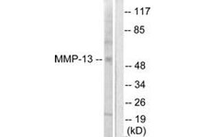 Western blot analysis of extracts from LOVO cells, using MMP-13 Antibody.