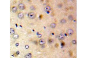 Used in DAB staining on fromalin fixed paraffin-embedded Brain tissue (FKBP1A anticorps  (AA 2-108))