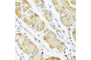 Immunohistochemistry of paraffin-embedded human stomach using C4BPB antibody (ABIN5973770) at dilution of 1/100 (40x lens). (C4BPB anticorps)