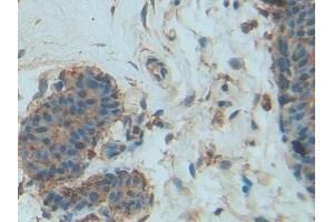 DAB staining on IHC-P; Samples: Human Mammary gland Tissue (PDGF-BB Homodimer (AA 82-190) anticorps)