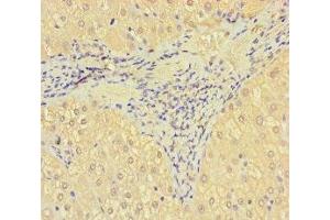 Immunohistochemistry of paraffin-embedded human liver tissue using ABIN7170681 at dilution of 1:100 (SRPK3 anticorps  (AA 1-300))