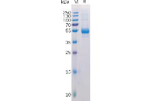 Human TN Protein, hFc Tag on SDS-PAGE under reducing condition.
