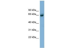 WB Suggested Anti-SLFN12 Antibody Titration: 0. (SLFN12 anticorps  (N-Term))