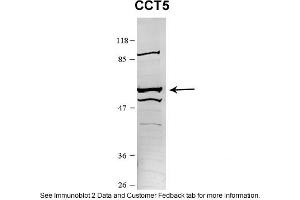 Sample Type: HEK 293 (10ug)Primary Dilution: 1:1000Secondary Antibody: conjugated goat anti-rabbitSecondary Dilution: 1:10,000Image Submitted By: Amy GrayBrigham Young University (CCT5 anticorps  (N-Term))