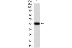 Western blot analysis using IL1RAPL1 mAb against human IL1RAPL1 (AA: 541-694) recombinant protein. (IL1RAPL1 anticorps  (AA 541-694))