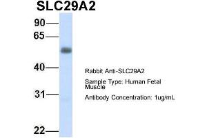 Host: Rabbit Target Name: SLC29A2 Sample Type: Human Fetal Muscle Antibody Dilution: 1.
