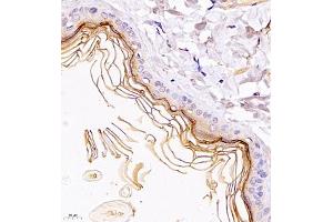 Immunohistochemistry of paraffin embedded rat skin using TR2IT1 (ABIN7075887) at dilution of 1:1500 (400x lens) (TXNRD3NB anticorps)