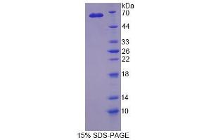 Image no. 1 for Cytokine Receptor-Like Factor 1 (CRLF1) (AA 138-422) protein (His tag,GST tag) (ABIN6237090)