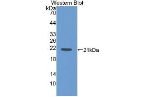 Detection of Recombinant FIL1d, Mouse using Polyclonal Antibody to Interleukin 1 Delta (FIL1d) (FIL1d anticorps  (AA 1-156))