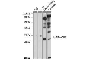 Western blot analysis of extracts of various cell lines, using MMACHC antibody  at 1:1000 dilution. (MMACHC anticorps  (AA 63-282))