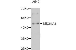 Western blot analysis of extracts of A-549 cells, using SEC61A1 Antibody (ABIN5998768) at 1:3000 dilution. (SEC61A1 anticorps)