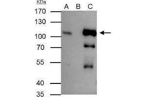 IP Image B-Raf antibody [N2C1], Internal immunoprecipitates B-Raf protein in IP experiments.