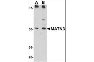 Western blot analysis of MATN3 in 3T3 cell lysate with this product at (A) 1 and (B) 2 μg/ml.