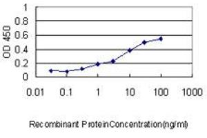 Detection limit for recombinant GST tagged SCNM1 is approximately 0.