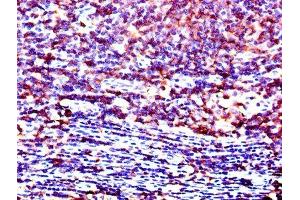 Immunohistochemistry of paraffin-embedded human lymph node tissue using ABIN7174038 at dilution of 1:100