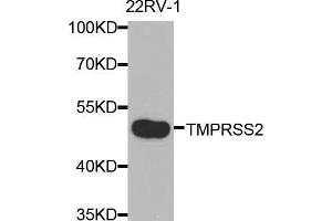 Western blot analysis of extracts of 22Rv1 cells, using TMPRSS2 antibody (ABIN5975349) at 1/2000 dilution. (TMPRSS2 anticorps)