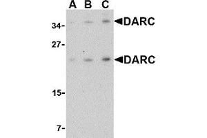 Western Blotting (WB) image for anti-Duffy Blood Group, Chemokine Receptor (DARC) (C-Term) antibody (ABIN1030355) (DARC anticorps  (C-Term))