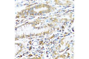 Immunohistochemistry of paraffin-embedded human stomach using HLA-DPB1 antibody at dilution of 1:100 (40x lens). (HLA-DPB1 anticorps)