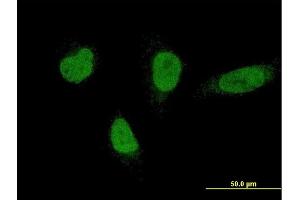 Immunofluorescence of monoclonal antibody to RNF220 on HeLa cell.
