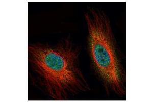 anti-Death Effector Domain Containing (DEDD) antibody