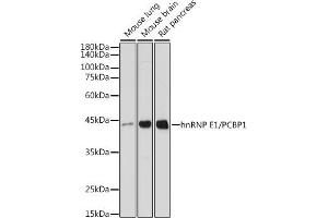 Western blot analysis of extracts of various cell lines, using hnRNP E1/hnRNP E1/PCBP1 antibody (ABIN7269448) at 1:1000 dilution.