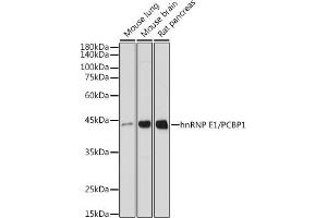 Western blot analysis of extracts of various cell lines, using hnRNP E1/hnRNP E1/PCBP1 antibody (ABIN7269448) at 1:1000 dilution. (PCBP1 anticorps)