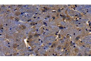 Detection of TICAM1 in Mouse Cerebrum Tissue using Polyclonal Antibody to Toll Like Receptor Adaptor Molecule 1 (TICAM1)