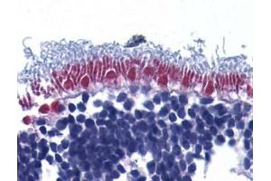 Immunohistochemistry of AIF in human retina with AIF (IN) antibody at 10μg/ml. (AIF anticorps)