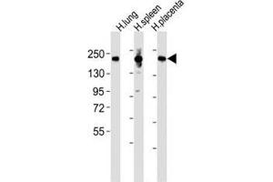 Western blot testing of MRC1L1 antibody at 1:2000 dilution and human samples: Lane 1: lung lysate; 2: spleen lysate; 3: placenta lysate; Predicted band size : 166 kDa.