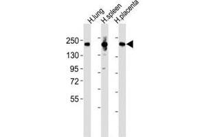 Western blot testing of MRC1L1 antibody at 1:2000 dilution and human samples: Lane 1: lung lysate; 2: spleen lysate; 3: placenta lysate; Predicted band size : 166 kDa. (Macrophage Mannose Receptor 1 anticorps  (AA 359-388))
