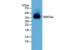 Figure. (PVRL2 anticorps  (AA 83-291))