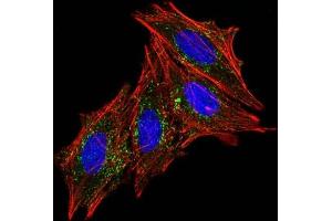 IF staining of HeLa cells using AF488 labeled CD63 Mouse Monoclonal Antibody (MX-49.