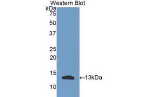 Western blot analysis of the recombinant protein. (PLAUR anticorps  (AA 123-216))