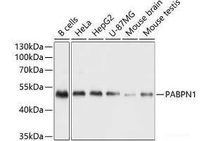 Western blot analysis of extracts of various cell lines using Polyclonal AntibodyPN1 Polyclonal Antibody at dilution of 1:1000. (PN1 anticorps)