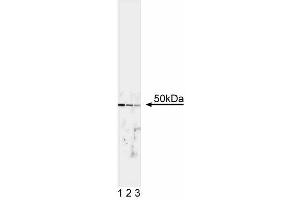 Western blot analysis of TFE3. (TFE3 anticorps)