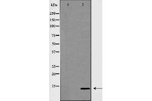 Western blot analysis of INSL3 expression in MCF7 cells,The lane on the left is treated with the antigen-specific peptide.