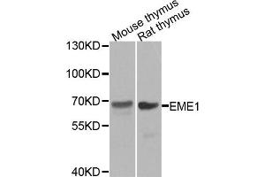 Western blot analysis of extracts of mouse thymus and rat thymus tissues, using EME1 antibody. (Crossover junction endonuclease EME1 (EME1) anticorps)
