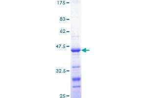 Image no. 1 for Catenin (Cadherin-Associated Protein), beta 1, 88kDa (CTNNB1) (AA 682-781) protein (GST tag) (ABIN1350672)