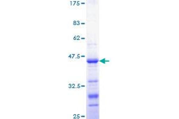 CTNNB1 Protein (AA 682-781) (GST tag)