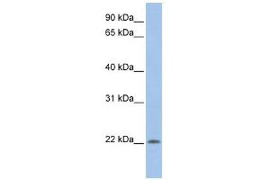 UBE2M antibody used at 1 ug/ml to detect target protein.