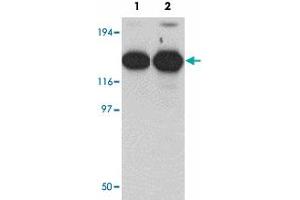 Western blot analysis of ZMYM2 in EL4 cell lysate with ZMYM2 polyclonal antibody  at (1) 0. (ZMYM2 anticorps  (C-Term))