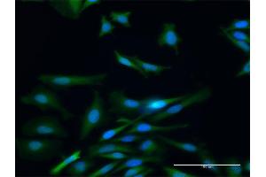 Immunofluorescence of purified MaxPab antibody to PADI4 on HeLa cell. (PAD4 anticorps  (AA 1-663))